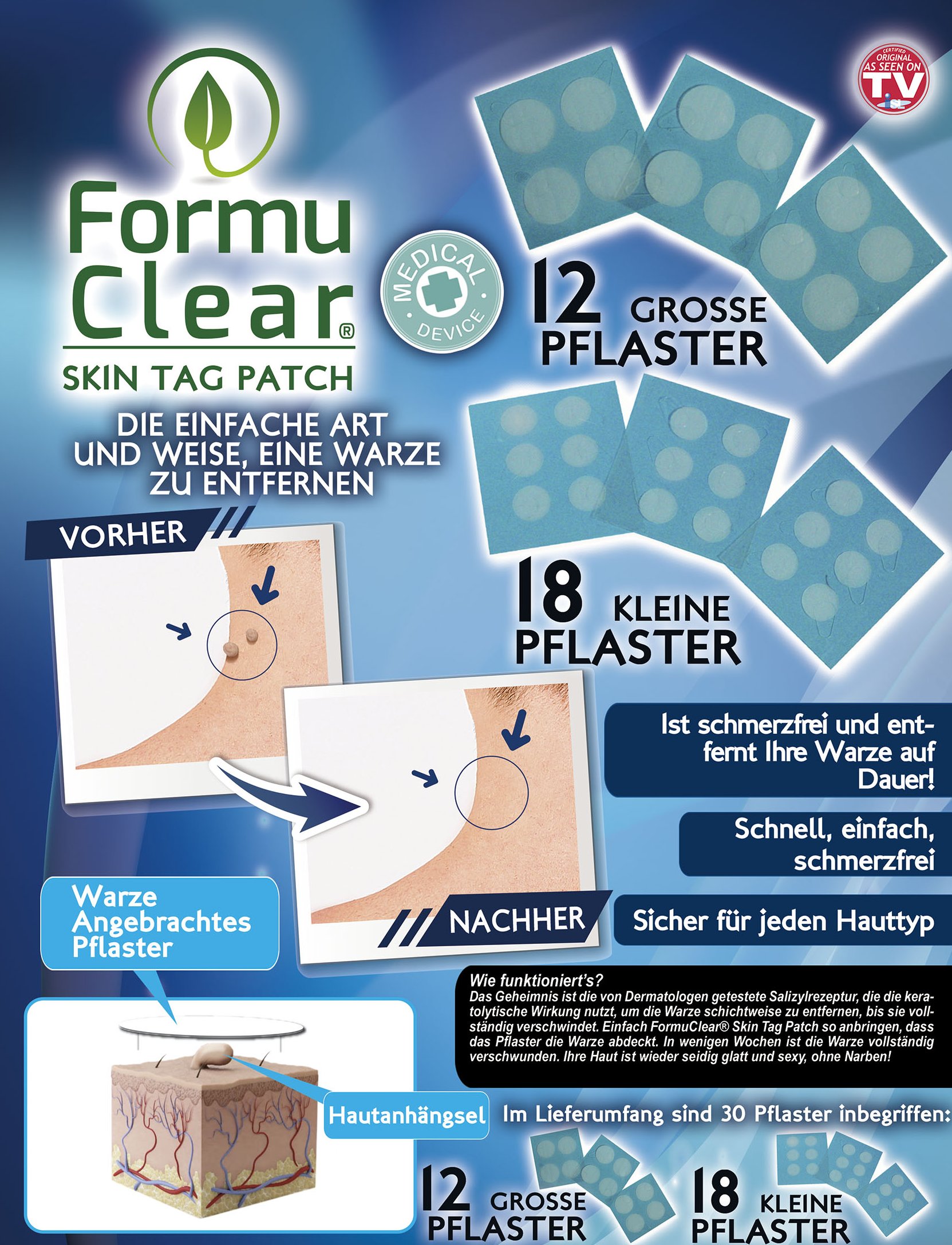 Formu Clear Skin Tag Patch - Assortiment de 30 pièces - Pansements pour verrues